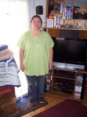 06-26-08 3 months after surgery.JPG