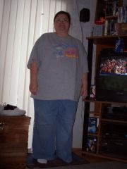 03-28-08 4 days after surgery.JPG