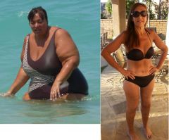 Claudia Before After 06 18 2015
